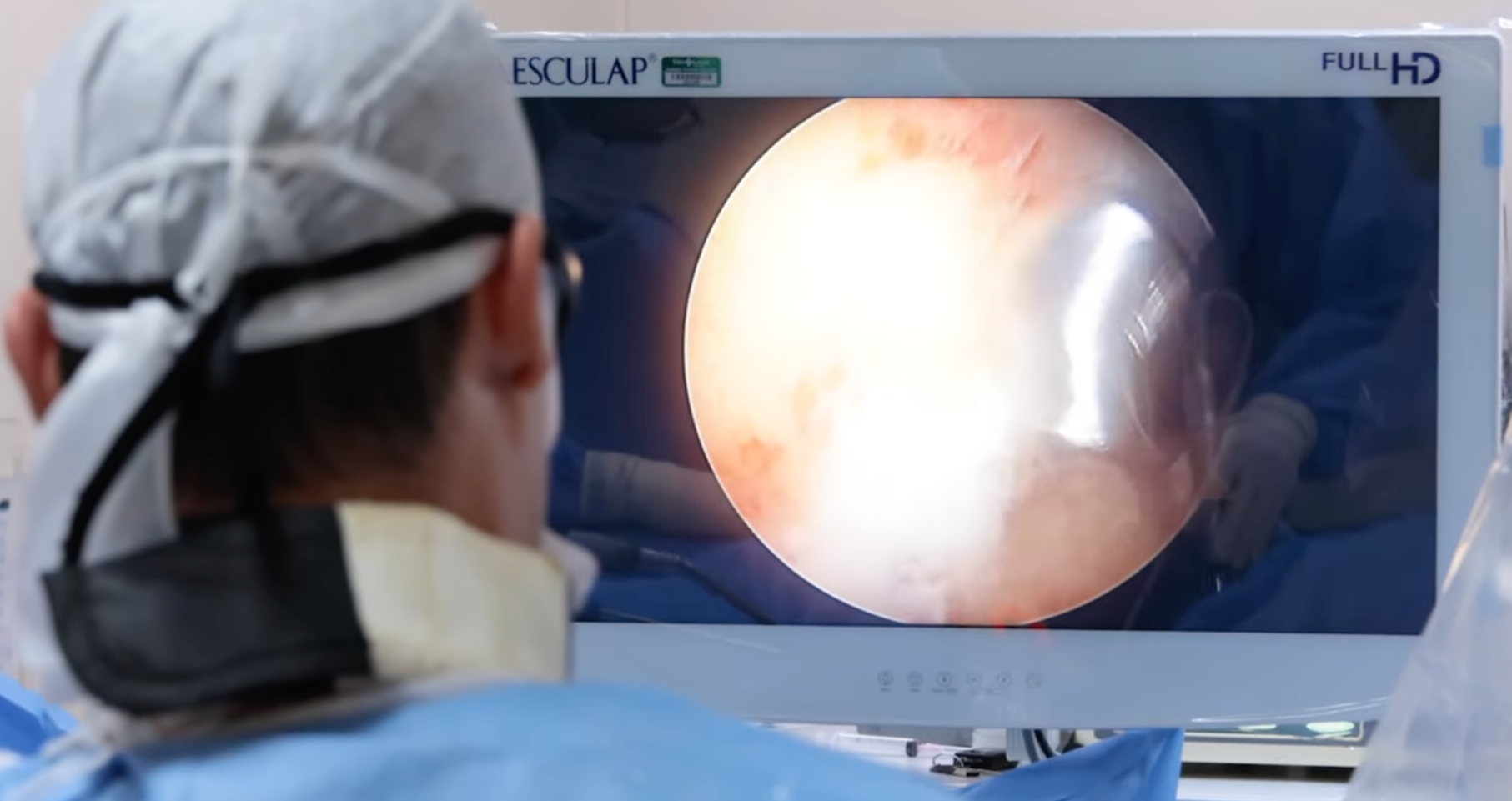Sente dores agudas no quadril? Se busca melhorar a sua qualidade de vida livre e tratar a dor, a cirurgia de videoartroscopia do quadril pode ser o que procura.